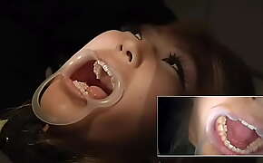 Dentist does work on Asian girl
