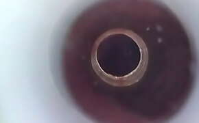 Endoscope camera in my urethra